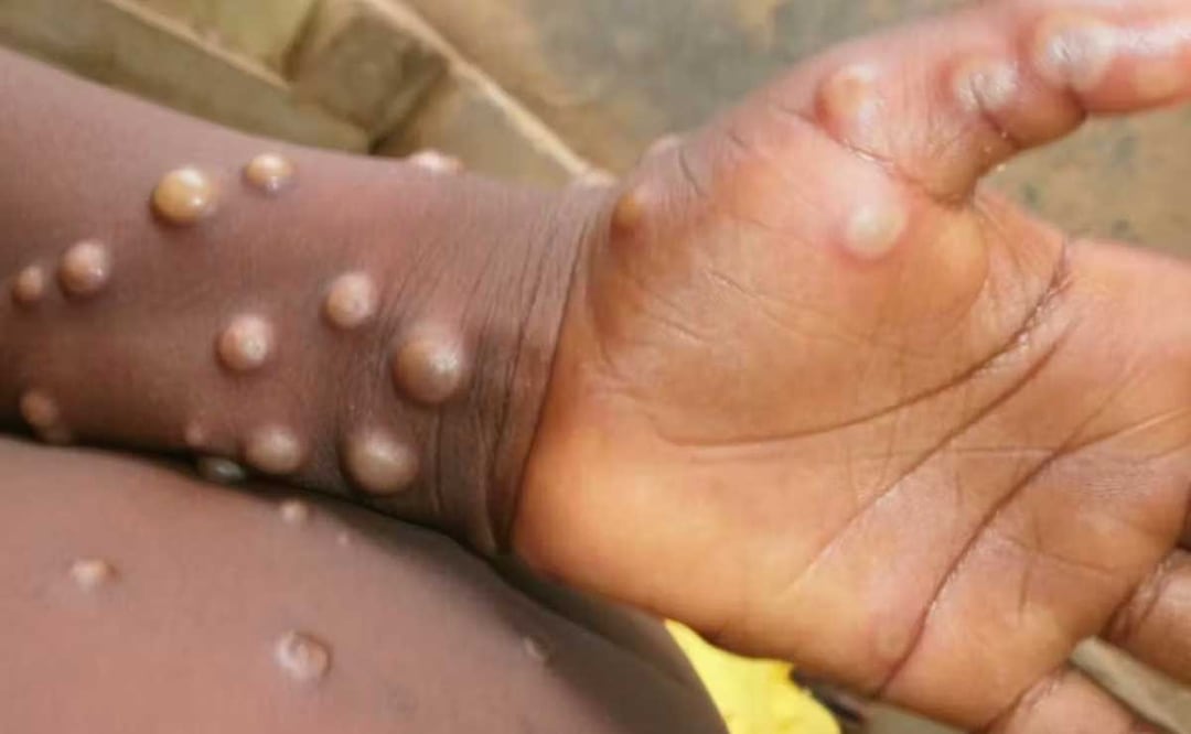 Foto: Archivo El Universal