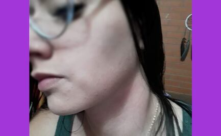 Mi pareja me ahorcó y casi me mata: la denuncia de una víctima de violencia