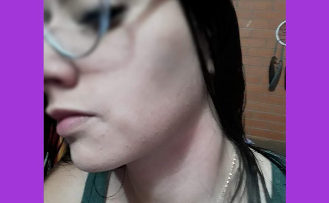 Jaiz Sarmiento denunció a su pareja en redes sociales por violencia familiar | IMAGEN: Especial