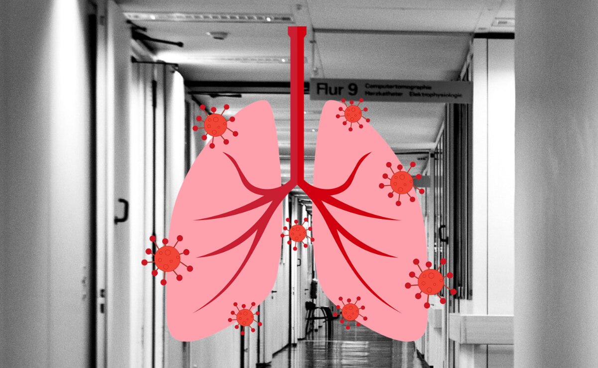 ¿Nueva pandemia? Esto se sabe sobre el Virus Metapneumovirus