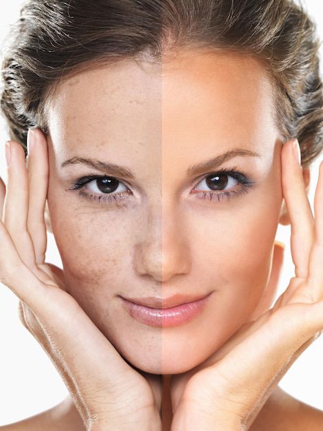 Beneficios de la mascarilla de leche y miel. Fuente: Freepik.