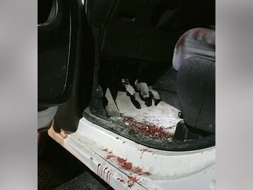 Balean a padre de familia durante un asalto en Nicolás Bravo