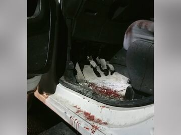 Balean a padre de familia durante un asalto en Nicolás Bravo