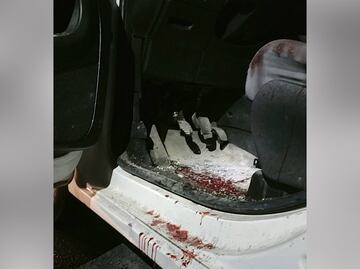 Balean a padre de familia durante un asalto en Nicolás Bravo