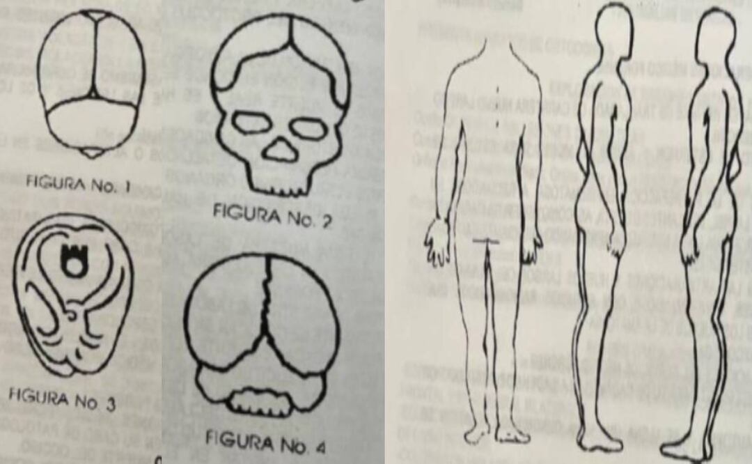 Las dos autopsias de Debanhi Escobar