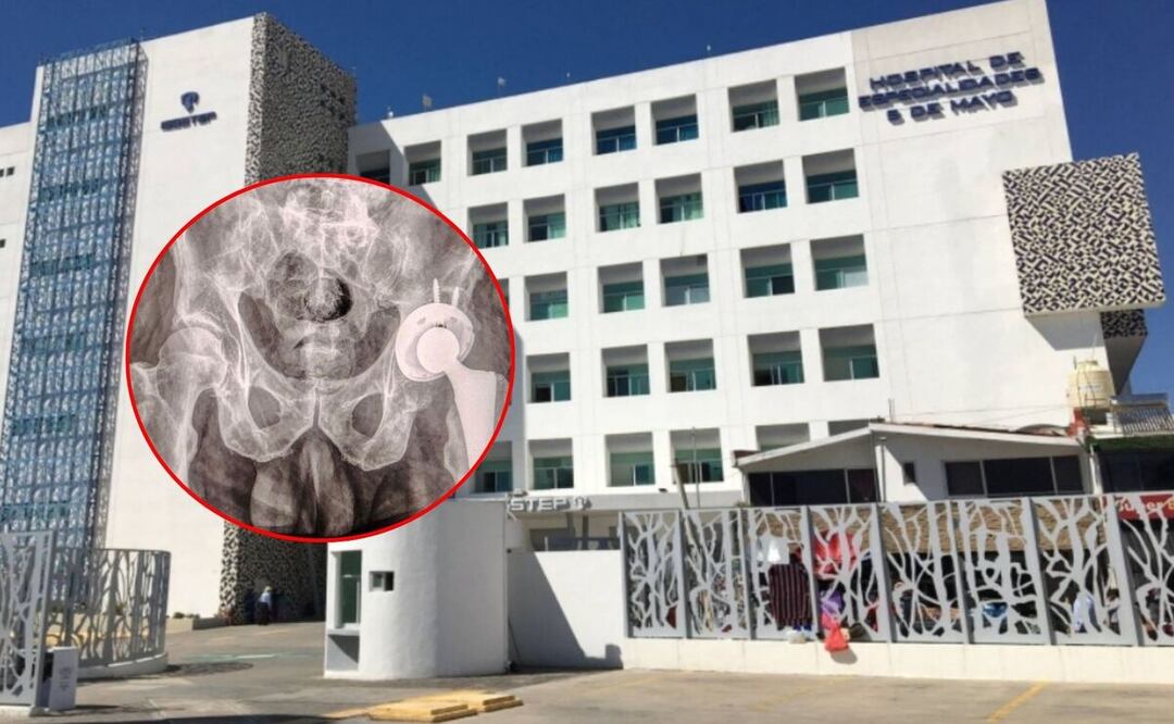 Marca un hito en la atención integral de enfermedades osteoarticulares | Foto: Gobierno del Estado