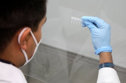 46 personas vacunadas están hospitalizadas por Covid