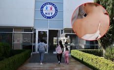 Niño poblano muere por sarampión en hospital de Tlaxcala