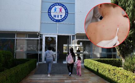 Niño poblano muere por sarampión en hospital de Tlaxcala