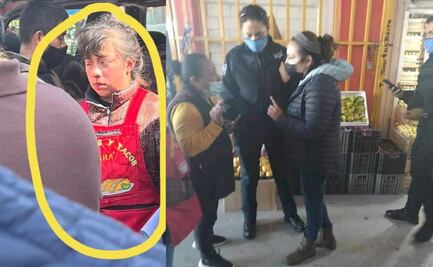 Mujer celosa le rompe la nariz a niña de 12 años por mirar a su esposo