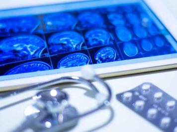 ¿Qué es una hemorragia cerebral y cómo prevenirla?