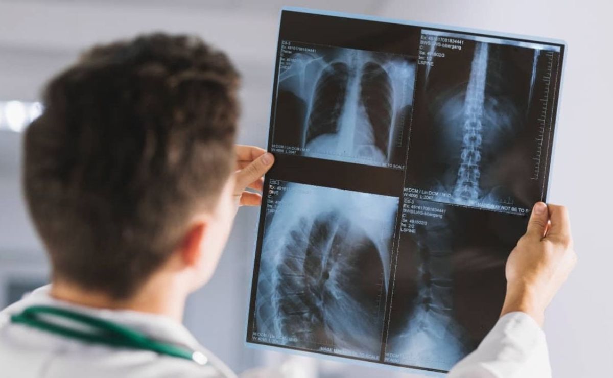 La radiología es una de las carreras que están en riesgo de desaparecer por la Inteligencia Artificial, ya que se puede sistematizar | Foto: Especial