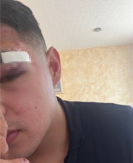 Jóvenes fueron golpeados por el personal del bar Ferina