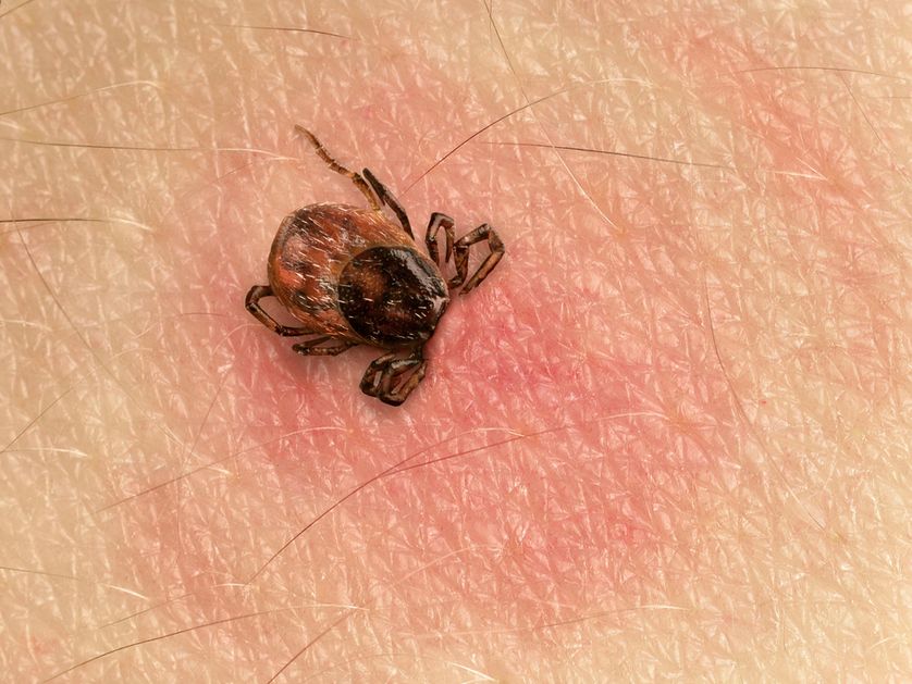 Es importante buscar atención médica si se sospecha de la enfermedad de Lyme, especialmente si se ha estado en áreas donde hay riesgo de picaduras de garrapatas y se presentan estos síntomas.

Foto: Producción El Universal Puebla