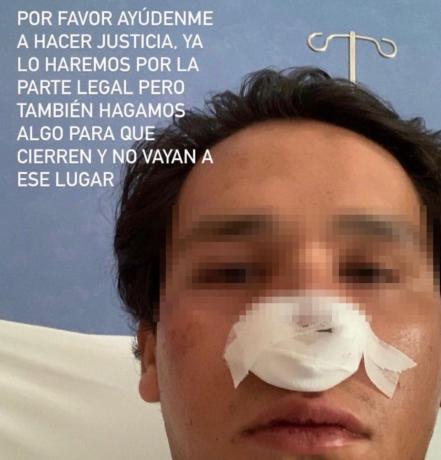 Jóvenes fueron golpeados por el personal del bar Ferina