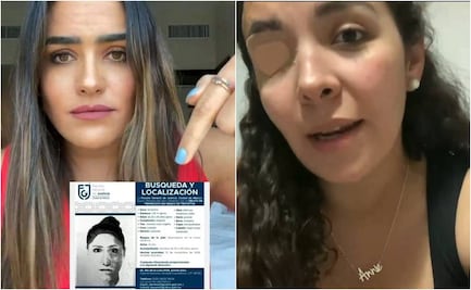 A dos años de ser atacada con ácido, Helena exige justicia; diputada ofrece recompensa