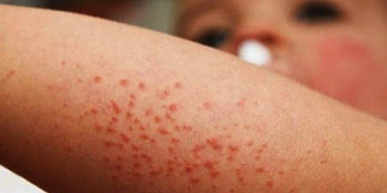 El virus Coxsackie se propaga principalmente en escuelas | Foto: Gobierno de Chihuahua