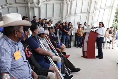 Esto necesitas para solicitar una prótesis al DIF de Puebla