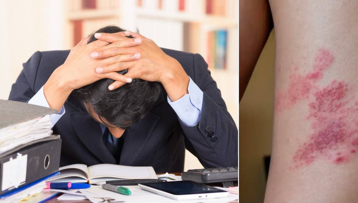 El estrés crónico está relacionado con la disminución de las respuestas de anticuerpos | Foto: shutterstock