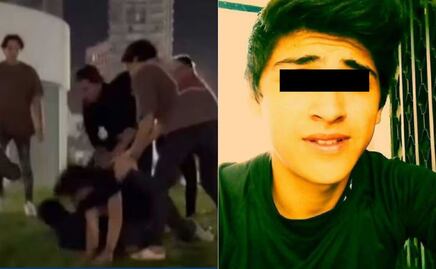 Neto Calderón no perderá su ojo, pero será sometido a intensa cirugía