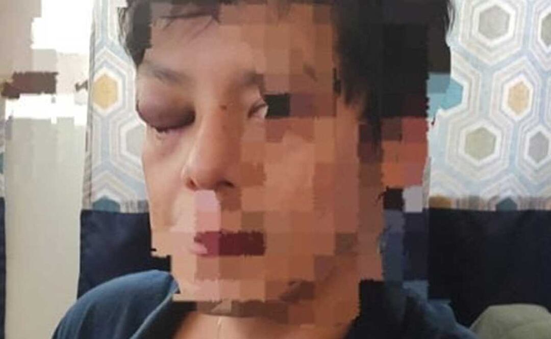 Un estudiante de medicina de la BUAP fue brutalmente golpeado en un bar. | Foto: Redes Sociales