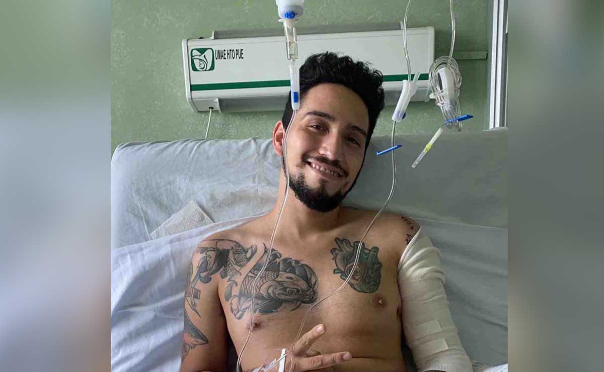 Poblano aprovecha TikTok para conseguir prótesis tras amputación