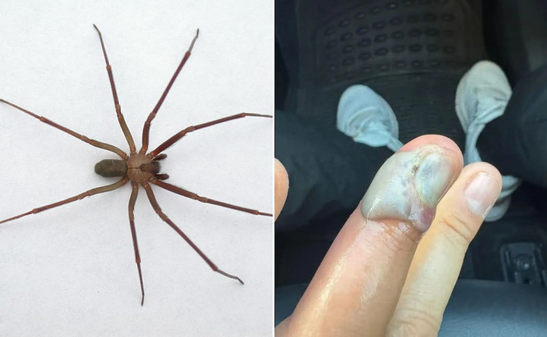 Una negligencia médica en Puebla puso en peligro la vida de un joven picado por una araña violinista | Foto: Gobierno de México / Facebook