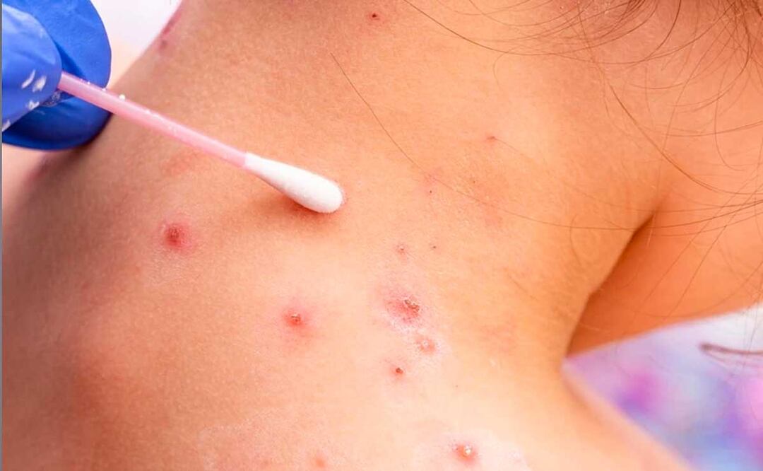 Foto: Archivo El Universal