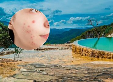 Descubre cómo llegar desde Puebla a las aguas curativas que te alivian del acné y la caspa