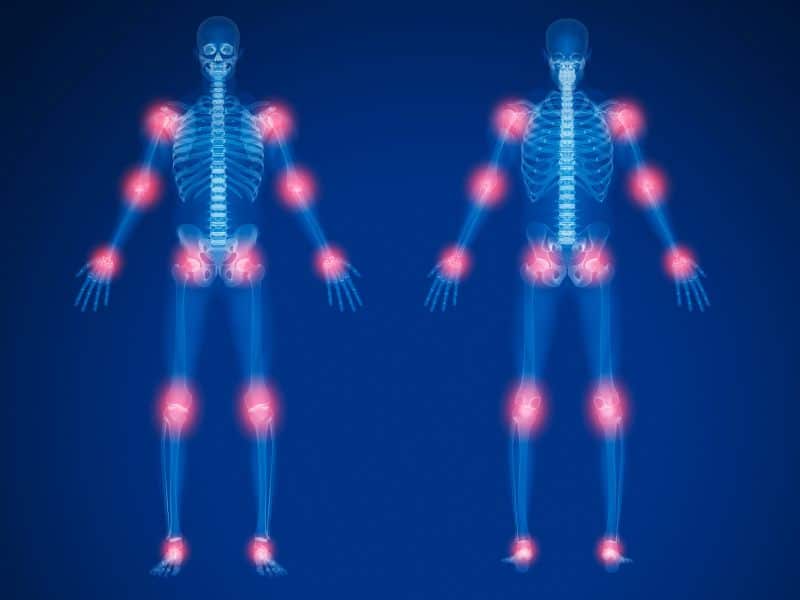 Esta situación aumenta el riesgo de fracturas y enfermedades como la osteoporosis, que afectan la fortaleza de los huesos. Factores como la falta de actividad física, una dieta inadecuada en calcio y vitamina D, y estilos de vida poco saludables contribuyen a este problema. 

Foto: Producción El Universal Puebla