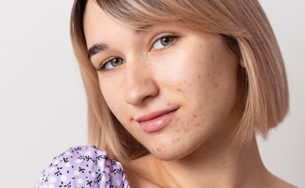 Quita las manchas de la piel del rostro con esta mascarilla a base de un común y económico alimento