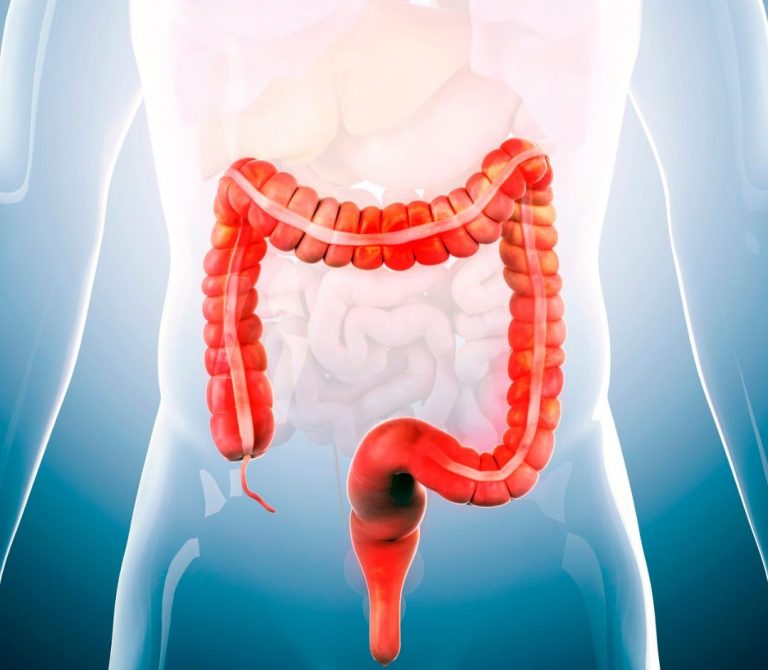 Es importante recordar que los desencadenantes de los síntomas pueden variar de una persona a otra, por lo que puede ser útil llevar un diario de alimentos para identificar qué alimentos específicos pueden estar causando problemas. 

Foto: Producción El Universal Puebla