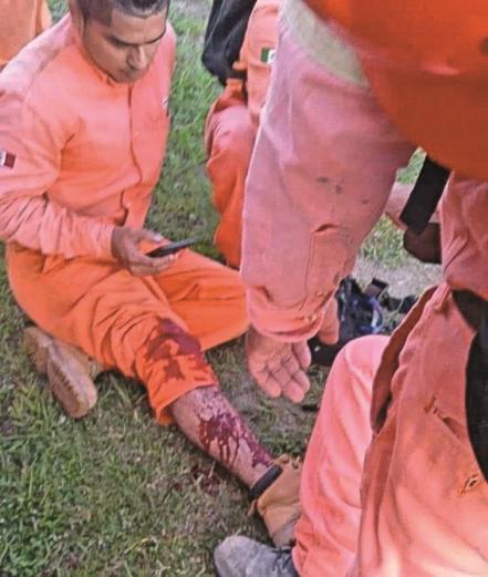 Cuatro trabajadores de Dos Bocas son heridos por policía
