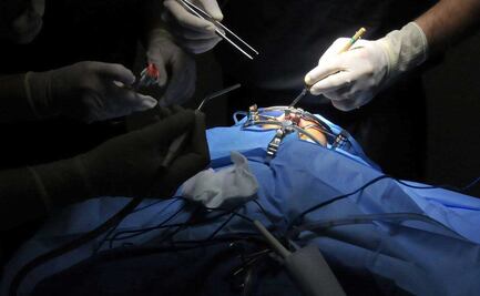 Más de 3 mil poblanos esperan un trasplante para sobrevivir 