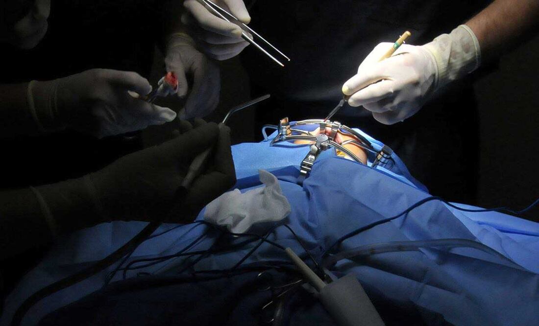 La principal fuente de donación de órganos es cadavérica | Foto: agencia Es Imagen para El Universal Puebla