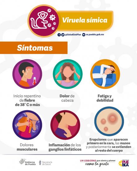 Hay dos casos de viruela del mono en Puebla 