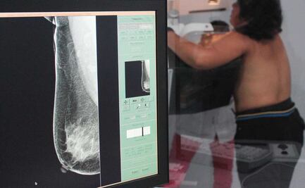 Octubre Rosa: en estos lugares hay mastografías gratis o con descuento en Puebla