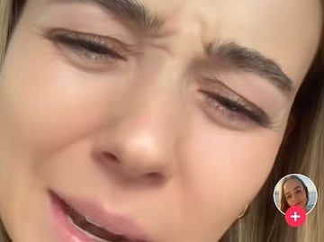 Mujer impresiona a todos en Tik Tok al descubrir algo desagradable en sus ojos