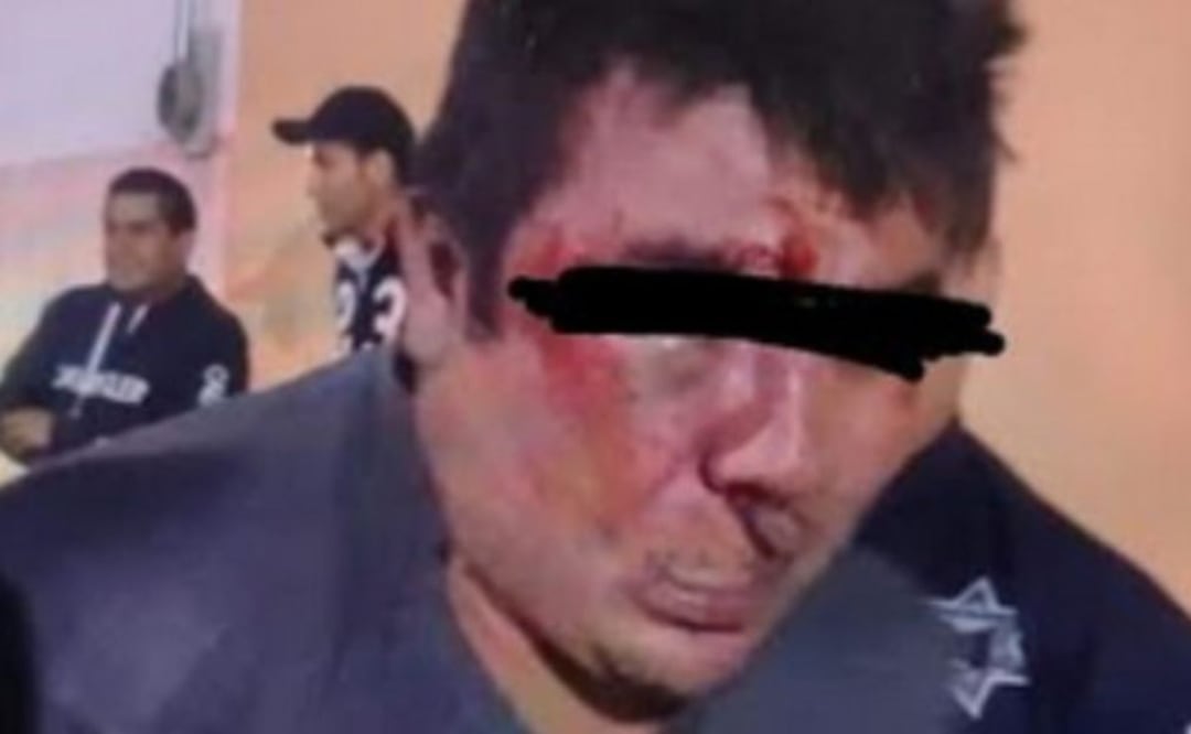 Un presunto ladrón fue rescatado por policías tras ser casi linchado en Acatzingo | Foto: Municipios