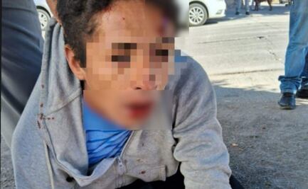 Ladrón intenta asaltar a adulta mayor en UPAEP y es detenido por ciudadanos