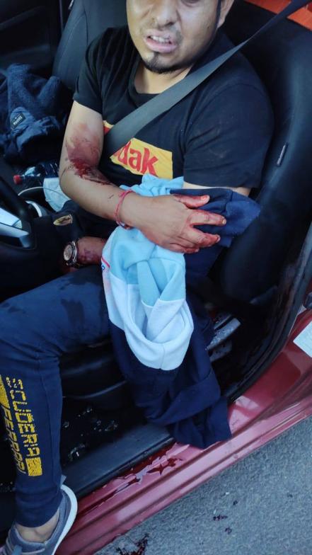Balean a conductor de taxi en intento de asalto en Xonacatepec