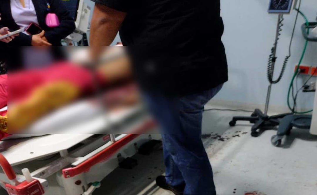 Según reportes preliminares se suscitó una pelea entre huehues y asistentes al Carnaval Huejotzingo 2023 | Foto: Especial