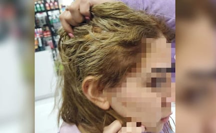 ¡Cuidado! Mujer pierde cabello tras acudir a estética Studio S de Huexotitla