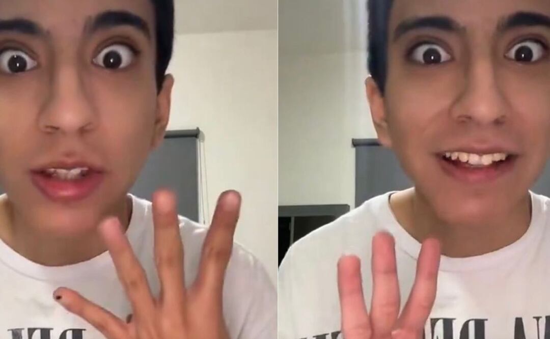 ¿Es en serio? Joven se queja de ser de piel blanca | Foto: X Prófugos del Ácido Fólico