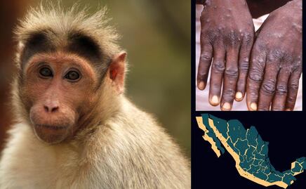 Mpox: ¿En qué estados de la República Mexicana se ha detectado?