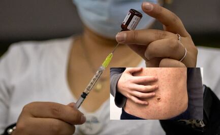 Sarampión: ubica aquí el centro de vacunación más cercano y conoce los requisitos