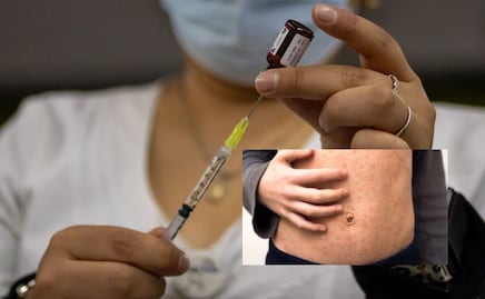 Sarampión: ubica aquí el centro de vacunación más cercano y conoce los requisitos