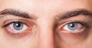 Expertos del Instituto Mexicano del Seguro Social (IMSS) aconsejan a las personas proteger sus ojos de las altas temperaturas, la radiación solar y la contaminación que se presentan durante la temporada de calor.

Foto: Producción El Universal Puebla