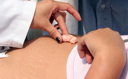 Corte avala derecho de la objeción de conciencia; no es restricción al derecho a la salud