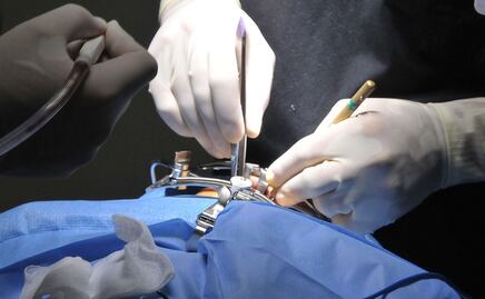 Tratamientos estéticos que salieron mal en Puebla 